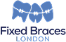 Fixed Braces London